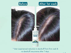 WishCare AHA BHA Anti-Dandruff Shampoo ( 250 ML )