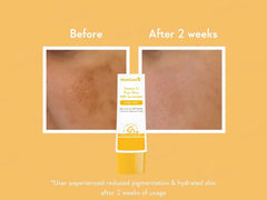 WishCare Vitamin C Pure Glow Milk Ultra Light Sunscreen SPF 50+ PA++++ ( 50 GM )